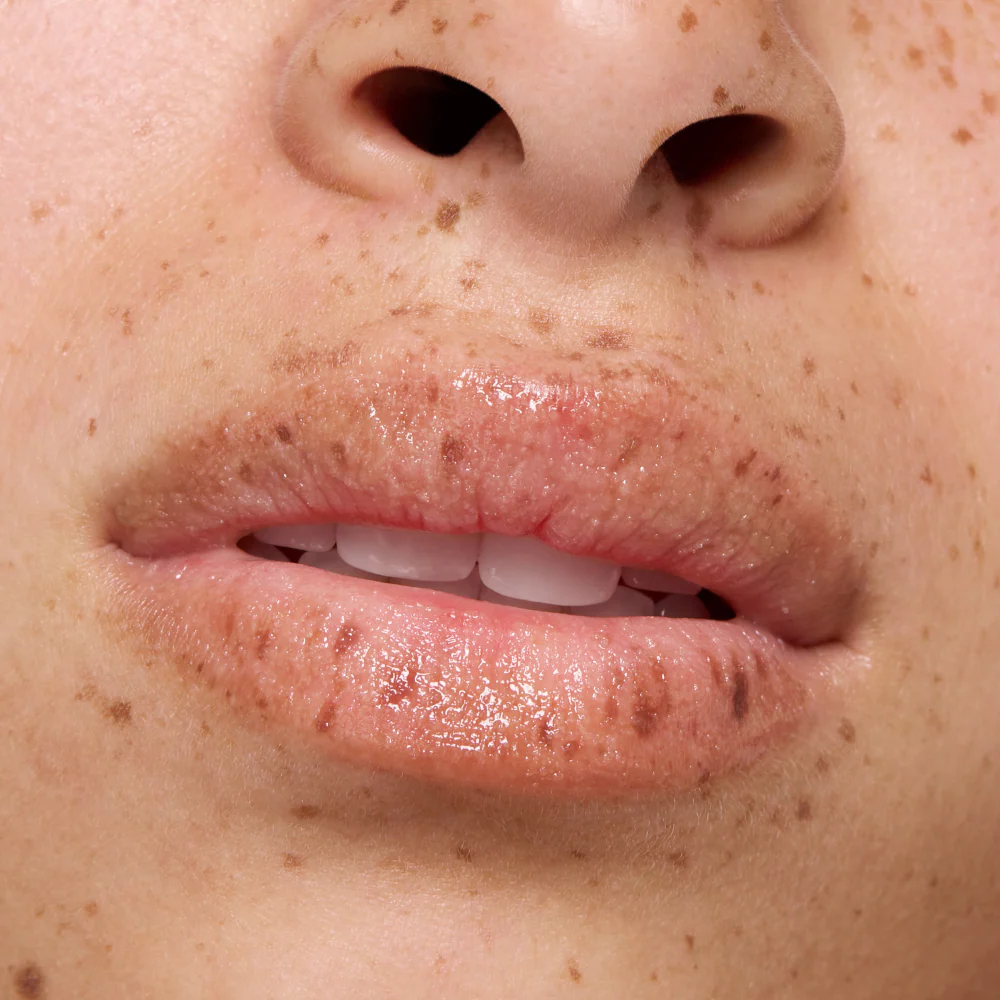 lip care SUGAR SCRUB - Image 8